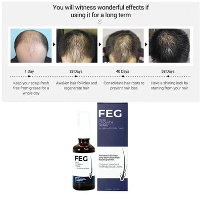 FEG Hair Growth Spray 1 Fl Oz Anti-Dandruff & Frizz Control