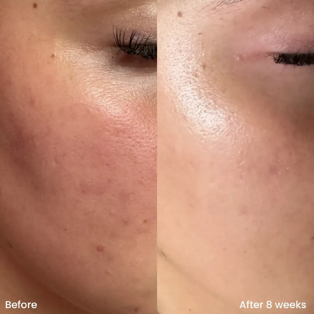 Niacinamide Brightening Serum