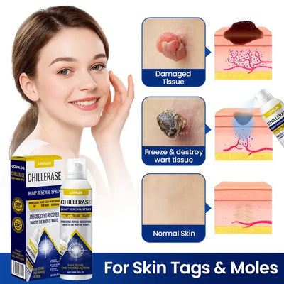 Timilk® ChillErase Bump Renewal Spray