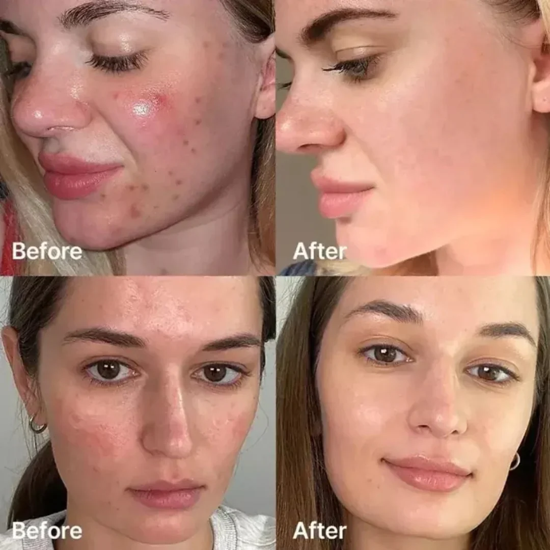 Niacinamide Brightening Serum