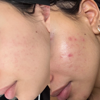 Niacinamide Brightening Serum