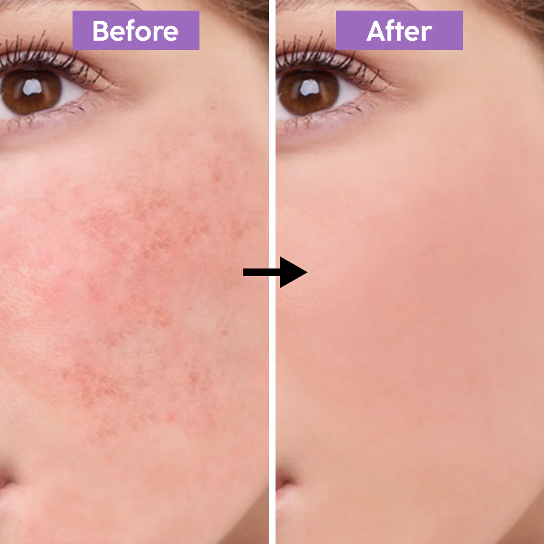 Niacinamide Brightening Serum